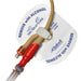 Statlock® Foley Stabilization Device - FOL0102 - Medical Supply Surplus